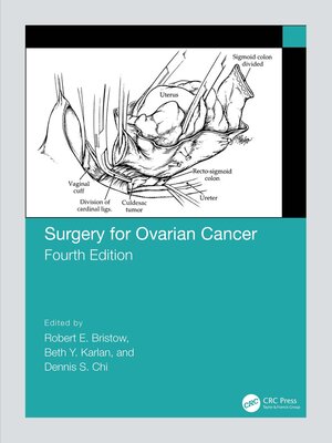 cover image of Surgery for Ovarian Cancer